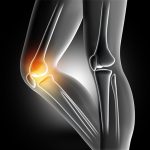 3D female medical image of bones in knee